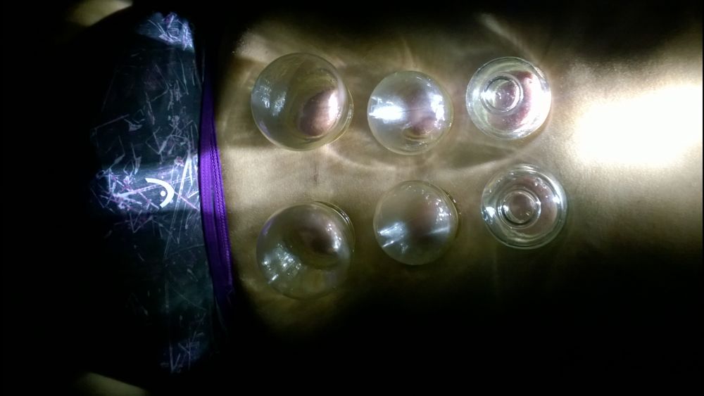 Behandlung durch Cupping